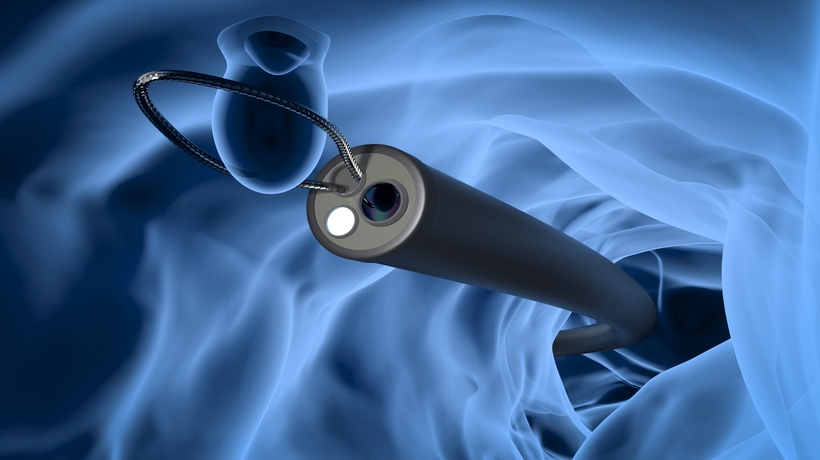 Endoscopy Diagnosis and Treatment with AI Implementation